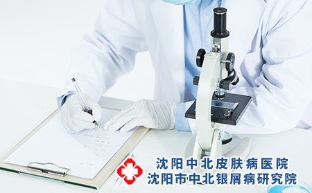 沈阳中北银屑病研究所怎么样