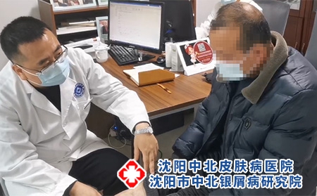 沈阳看银屑病-沈阳中北-解密治疗银屑病的终极秘籍!