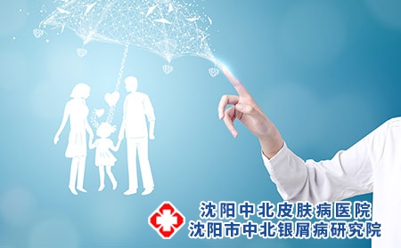 怎么预防子女患银屑病？