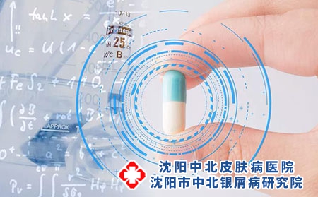 得了牛皮癣怎么办呢 尽早发现尽早用药医治最明智