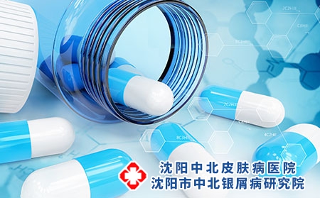 治疗牛皮癣的方法你也要好好斟酌