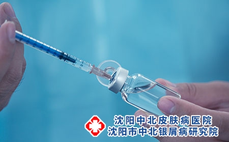 沈阳治疗银屑病医院：生物制剂对银屑病患者有用吗