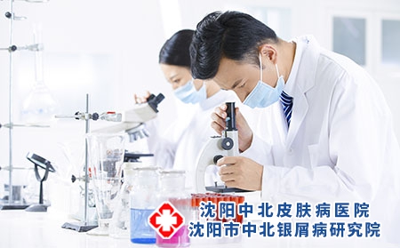沈阳哪家是好的银屑病医院