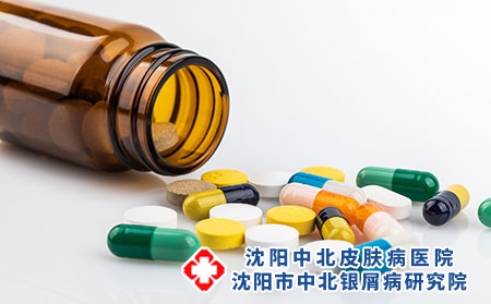 沈阳治疗银屑病费用大概多少