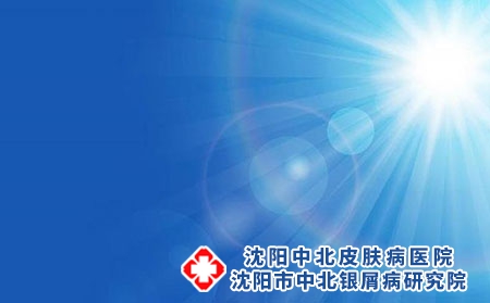 怎样在夏季防止红皮病型牛皮癣加重?
