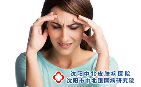 点滴状银屑病到底能否治好呢?