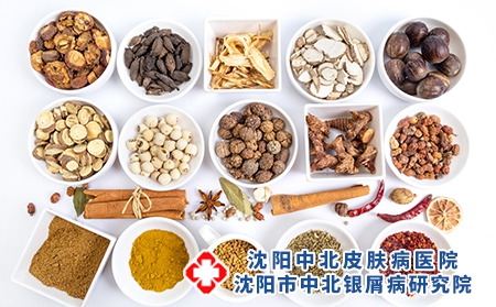 牛皮癣忌口什么？