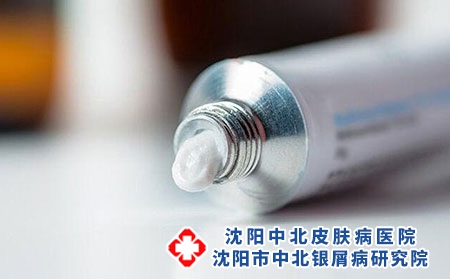 牛皮癣用什么软膏治疗好?