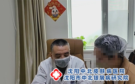 银屑病都能打生物制剂吗