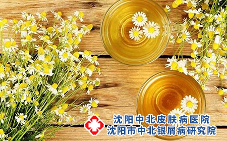 银屑病患者吃什么食物比较好