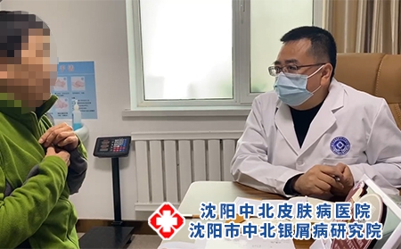 孩子面部起牛皮癣怎么办