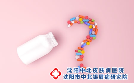 平常治疗牛皮癣药物有哪些