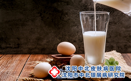 吃纯牛奶对牛皮癣有好处吗？