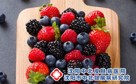 沈阳银屑病治疗医院：牛皮癣吃葡萄可以吗