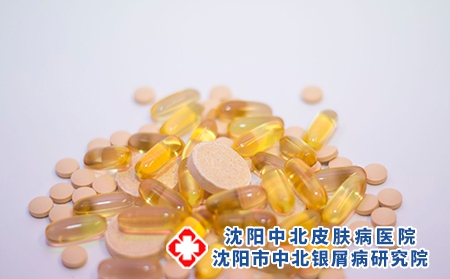 维生素有治疗牛皮癣的效果吗？