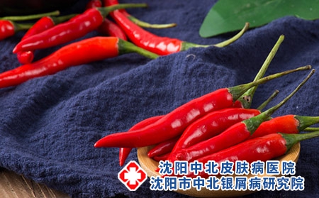 沈阳治银屑病医院中北专业：为什么爱吃辣的更容易患牛皮癣
