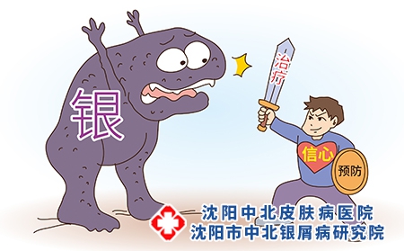 治疗牛皮癣瘙痒三大方法来帮您
