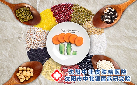 红皮型牛皮癣治疗偏方有哪些-科学饮食很重要