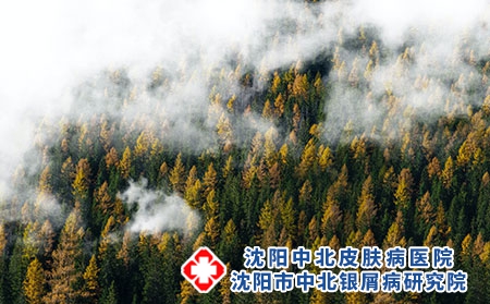 ​春季银屑病为什么会出现“假愈”现象?患者要注意什么?