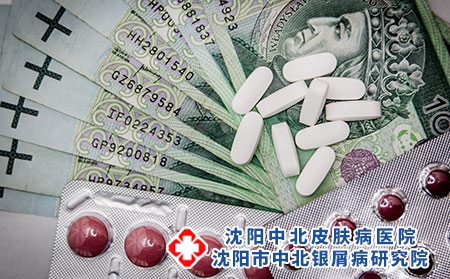 治疗银屑病用什么方法比较好呢?