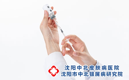 沈阳牛皮癣用药需谨记哪3忌