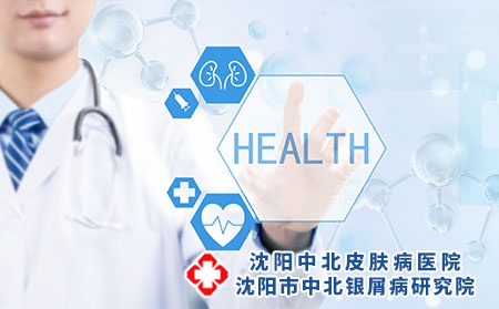 什么因素影响沈阳牛皮癣的治疗价格