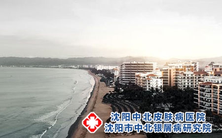 精神因素对红皮型银屑病的影响有哪些