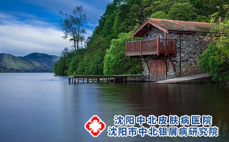 红皮型银屑病患者如何缓解病情
