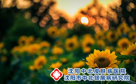 春季预防牛皮癣从哪方面入手?