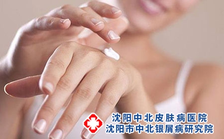 给牛皮癣患者的3点建议 牛皮癣的注意事项有哪些呢