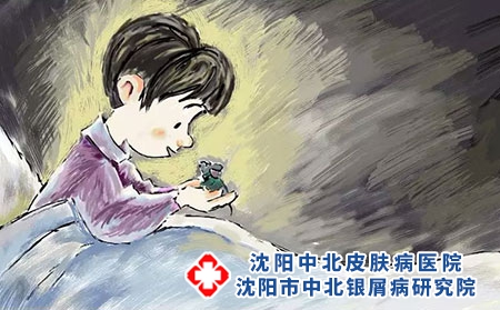 沈阳银屑病皮损难以消退的原因主要包括什么?