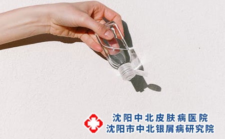 银屑病会有什么恶化现象