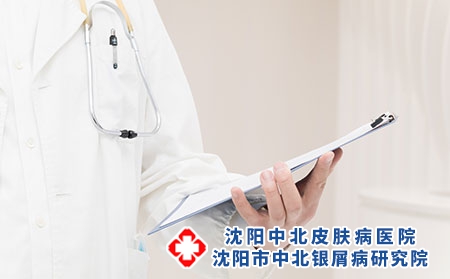 沈阳牛皮癣医院：牛皮癣发生的原因有什么