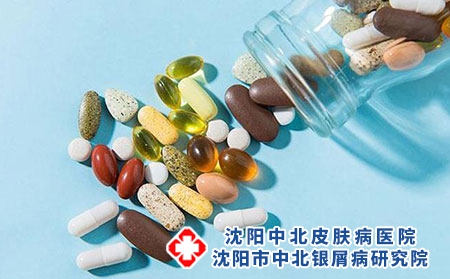 患上牛皮癣应该怎么办 如何治疗牛皮癣