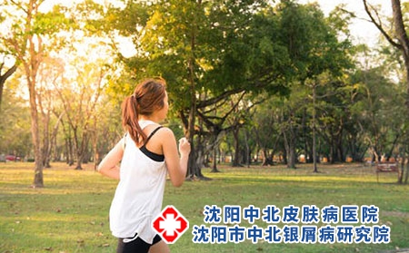 春季银屑病红斑脱皮怎么治疗