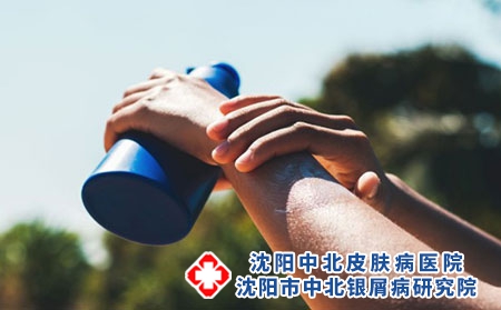 生活中哪些因素会导致牛皮癣 牛皮癣患者的注意事项