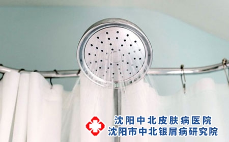 牛皮癣患者洗澡时注意事项
