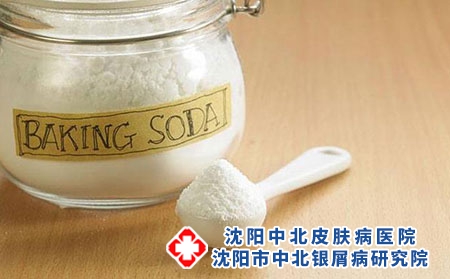 银屑病该如何治疗呢?