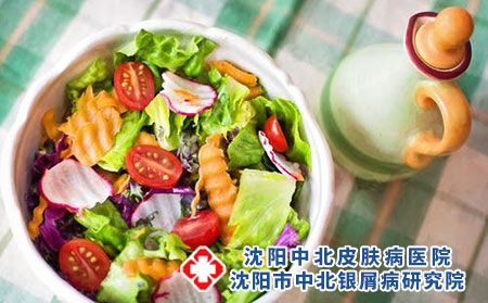 得了牛皮癣之后要注意什么