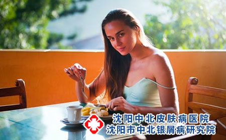 怎么有效预防牛皮癣复发