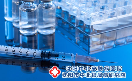 如何治疗沈阳牛皮癣疾病呢