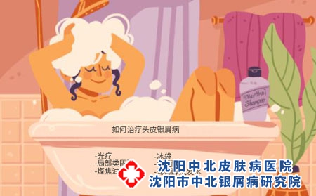 沈阳看银屑病医院：青少年银屑病该如何正确治疗