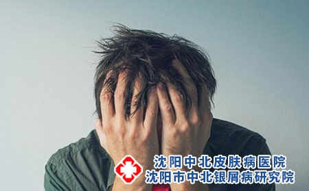寻常型银屑病的危害有哪些?