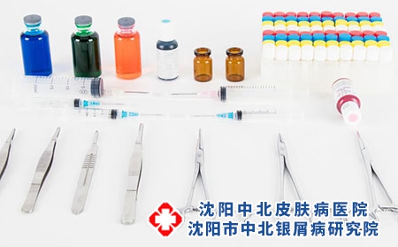 偏方可以治银屑病吗