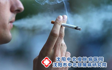 抽烟多了会得牛皮癣吗？