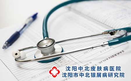 沈阳怎么有助于治疗银屑病