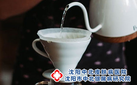 怎样更好预防牛皮癣复发？