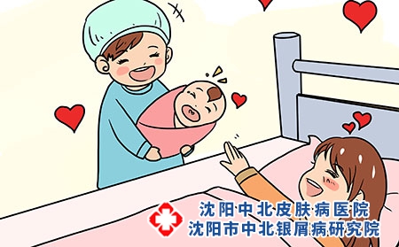 怀孕期间患上牛皮癣该怎么办?