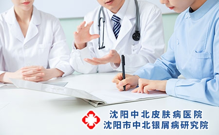 重症牛皮癣患者治疗时要注意的四大事项