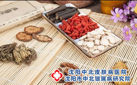 胳膊上有牛皮癣怎么用中药治疗？
